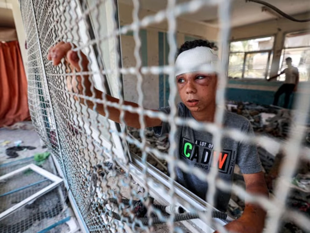 anak palestina terluka di gaza